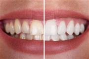 CLINICA DENTAL YTECNICA DENTAL thumbnail