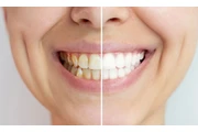 Dentista en Huntigton Park en Los Angeles