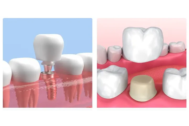 Dentista general y cosmético image 2