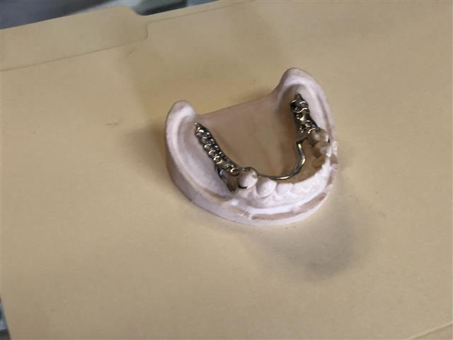 G & I Dental Lab image 2